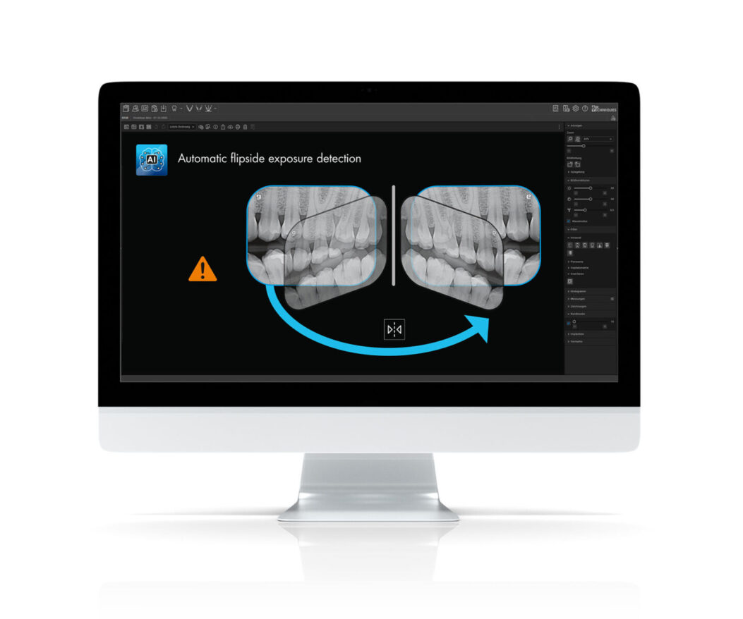 exposure detection-AT_VisionX